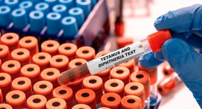 Diphtheria Outbreak Overwhelms Katsina Teaching Hospital as Children’s Ward Exceeds Capacity