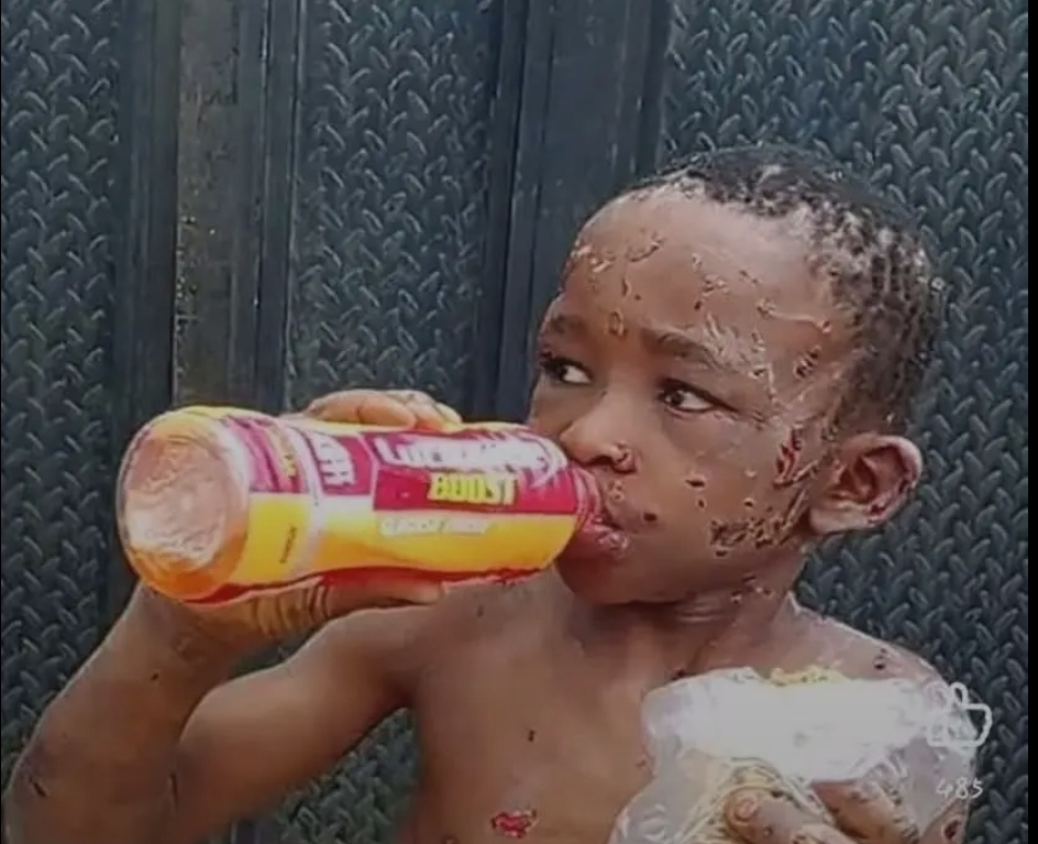Nigerian Police Arrest Couple Over Alleged Torture of 10-Year-Old Boy